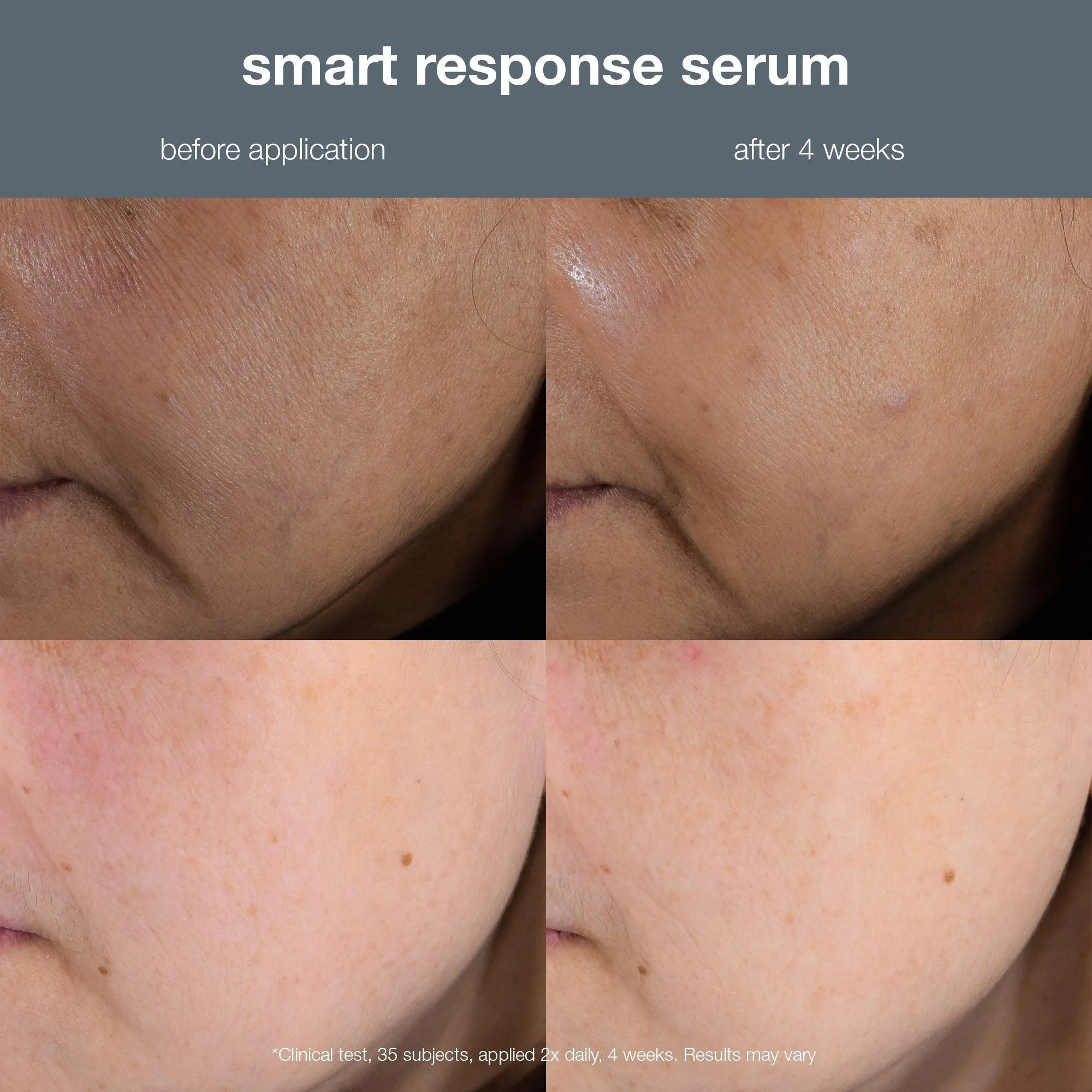 smart response serum kit (1 full-size   free travel and gua sha)